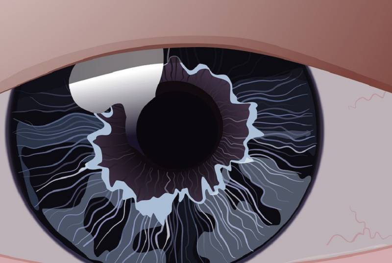Qu'est-ce que la cataracte et comment améliorer ma vue chez un opticien Marseille